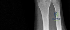 Illustration of explanation this patient - Dr. Mohammed Hutaif