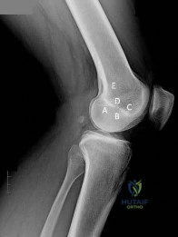 Orthopedic Surgery Board Review MCQs: AAOS Master Bank Part 221