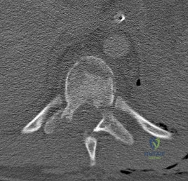 Orthopedic Surgery Board Review MCQs: AAOS Master Bank Part 215