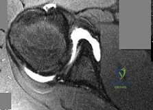 Master Basic Orthopedic MCQs Online & Test Your Knowledge