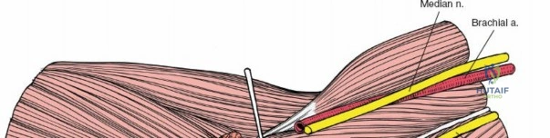 OITE & ABOS Orthopedic Board Prep: Practice Exam Part 30