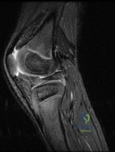 OITE & ABOS Orthopedic Board Prep: Practice Exam Part 88