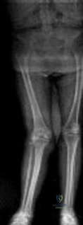 Test your skills: Orthopedic MCQs obtained from a year-old recon update.