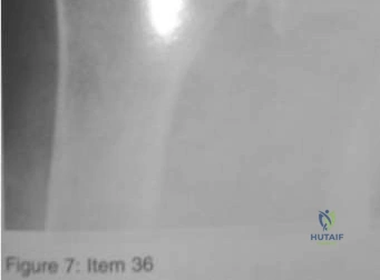 دليل شامل لأمراض العظام والإصابات الشائعة: العلاج والتعافي مع الأستاذ الدكتور محمد هطيف في صنعاء