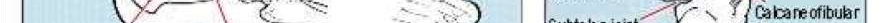 صورة توضيحية لـ خشونة المفاصل: دليل شامل للوقاية والعلاج المتقدم على يد الأستاذ الدكتور محمد هطيف في صنعاء