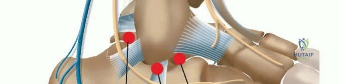 الدليل الشامل لعلاج التهاب العظم والغضروف السالخ والداء العظمي الغضروفي