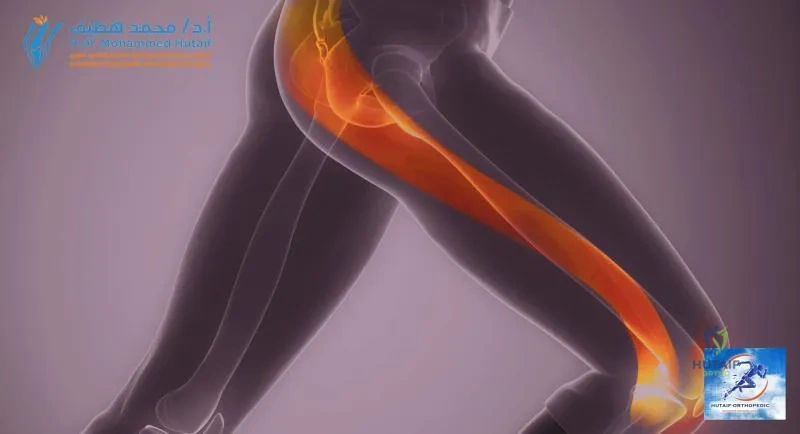 وداعاً لآلام إبهام القدم المتيبس: دليل شامل لخشونة مفصل إصبع القدم الكبير وخيارات العلاج المتقدمة