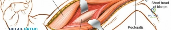 صورة توضيحية لـ مشاكل القدم والكاحل: دليل شامل للأسباب، الأعراض، وخيارات العلاج المتاحة في صنعاء