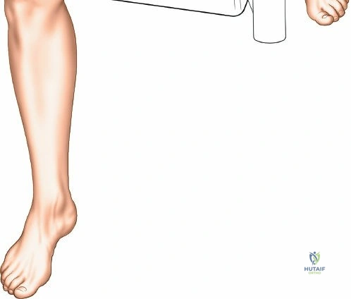 صورة توضيحية لـ التهاب المفاصل التنكسي: دليل شامل للعلاج والوقاية مع الأستاذ الدكتور محمد هطيف في صنعاء