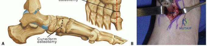 صورة توضيحية لـ آلام المفاصل المزمنة وأمراض العظام الشائعة: دليل شامل للتشخيص والعلاج في اليمن مع الأستاذ الدكتور محمد هطيف