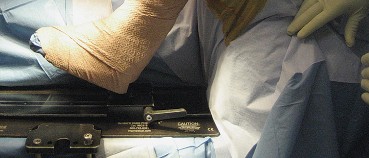 الدليل الشامل لعملية خياطة الأعصاب المحيطية وعوامل نجاح تجددها