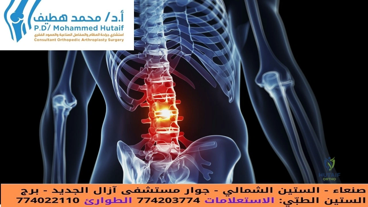 وداعاً لـ مشاكل العمود الفقري: دليلك الشامل لتخفيف الألم والعلاج.