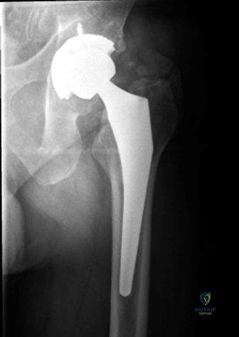 Clinical Image