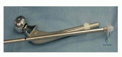 صورة طبية: استبدال مفصل الورك الكلي بالإسمنت الطبي: حل ناجح وموثوق لاستعادة الحركة