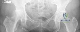 Clinical Image