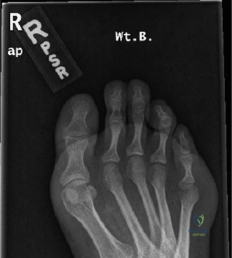 Clinical Image