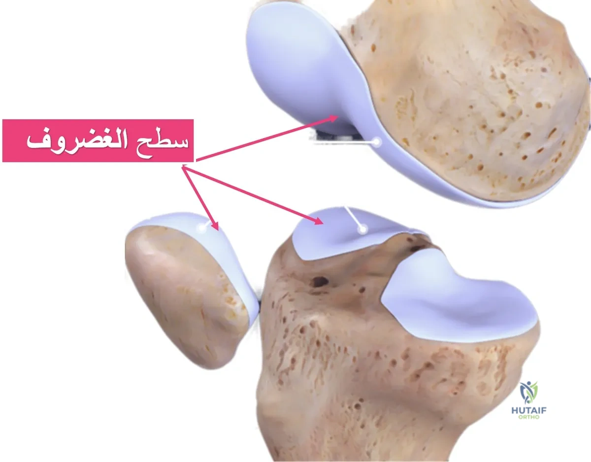 صورة الغضروف المفصلي