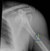Orthopedic Sport Review | Dr Hutaif Sports Medicine Rev -...