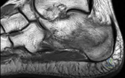 صورة طبية: دليل شامل لكسور وإصابات الجهاز الحركي: رعاية متقدمة في صنعاء مع الأستاذ الدكتور محمد هطيف
