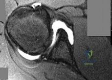Illustration of philadelphia pa lippincott - Dr. Mohammed Hutaif