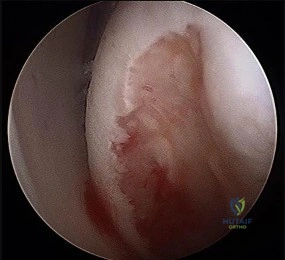 صورة توضيحية لـ دليل شامل لصحة العظام والمفاصل: استشارات وإجابات مع الأستاذ الدكتور محمد هطيف في صنعاء