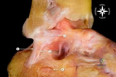 صورة طبية: دليل شامل لكسور وإصابات الجهاز الحركي: رعاية متقدمة في صنعاء مع الأستاذ الدكتور محمد هطيف