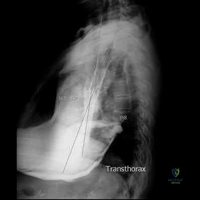 صورة طبية: دليل شامل لكسور وإصابات الجهاز الحركي: رعاية متقدمة في صنعاء مع الأستاذ الدكتور محمد هطيف