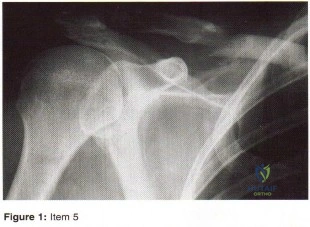 Orthopedic Surgery Board Review MCQs: AAOS Master Bank Part 193