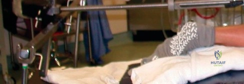 صورة طبية: منظار مفصل الفخذ: حل متقدم لآلام الورك ومشاكله المعقدة في صنعاء