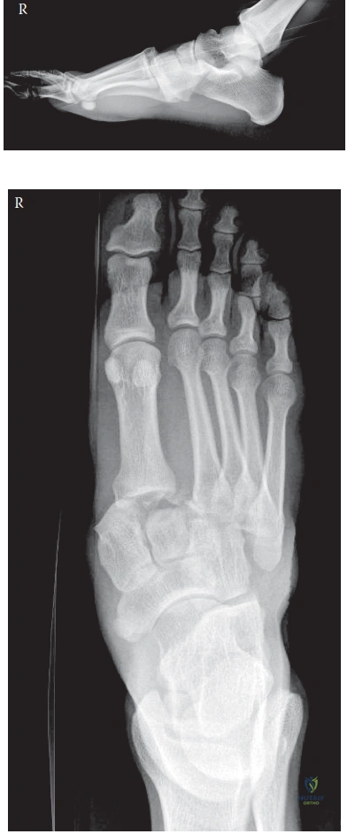 Clinical Image