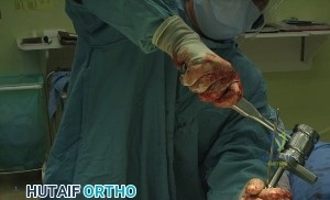 جودة حياة ممتازة بعد الجراحة