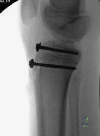Illustration of rotation of the foot - Dr. Mohammed Hutaif