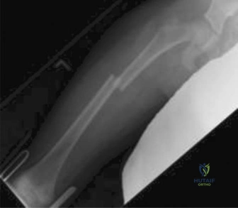 Clinical Image