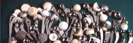 Illustration 1 for Maximizing Durability: Tribology and Bearing for Hip Implants