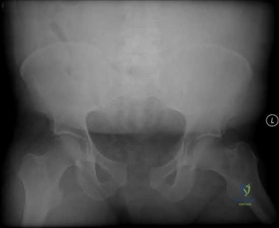 صورة طبية: دليل شامل لكسور وإصابات الجهاز الحركي: رعاية متقدمة في صنعاء مع الأستاذ الدكتور محمد هطيف