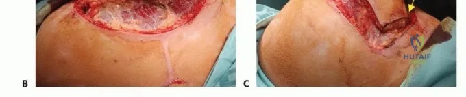 حالات الحوادث والإصابات المعقدة