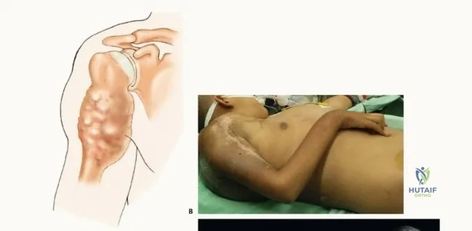 فريق طبي متكامل بقيادة الدكتور هطيف