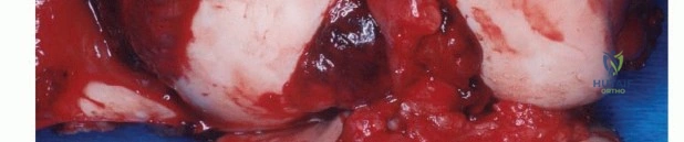 وصف طبي دقيق للمريض