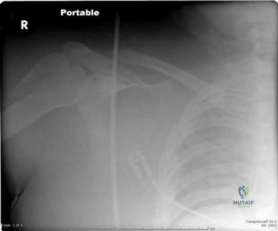 Master Cruciate Ligament ACL Injuries: Orthopedic MCQ Challenge
