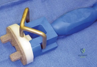 خيارات العلاج التحفظي للركبة