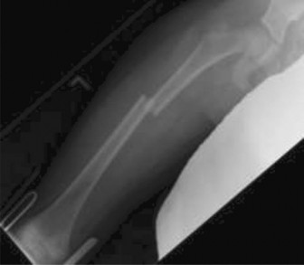 Orthopaedic Board Review: High-Yield Clinical MCQs