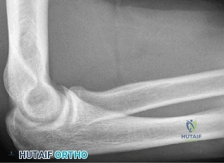 Clinical Image