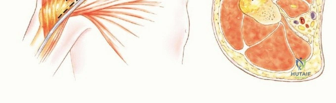 أجهزة التصوير المتقدمة للكتف