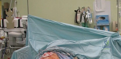 صورة توضيحية لـ ترميم سطح مفصل الورك: دليلك الشامل للمرضى المرشحين والموانع مع الأستاذ الدكتور محمد هطيف