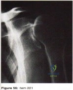 Orthopedic MCQs: Conquer Every Question a Yearold Patient Presents