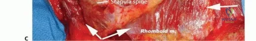 إغلاق الجرح والعناية التجميلية