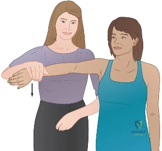 صورة توضيحية لـ كسر عظم العضد البعيد المعقد داخل المفصل: دليل شامل للمرضى مع الأستاذ الدكتور محمد هطيف
