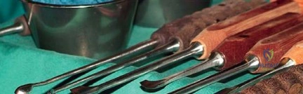 صورة طبية: جراحة استبدال مفصل الورك الملتهب في مرحلة واحدة: حل فعال وشامل مع الأستاذ الدكتور محمد هطيف