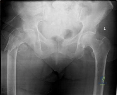 Orthopedic Surgery Mock Exam - Set 1F7639