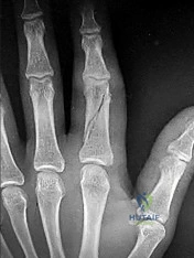 Orthopedic Hand MCQs: View Abstract & Master Cases from PubMed PMID
